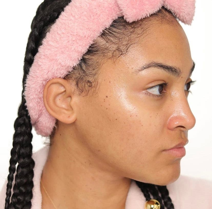 Woman with braided hair and pink headband showcasing glowing skin after using vegan antioxidant facial toner.